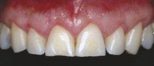 Dental Cases Before & After 11