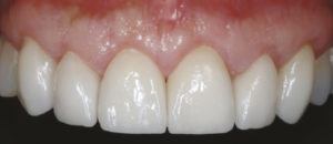Dental Cases Before & After 105