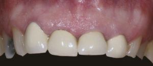 Dental Cases Before & After 104