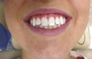 Dental Cases Before & After 102