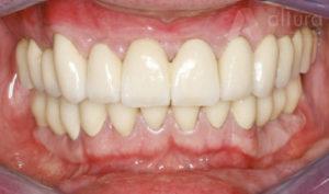 Dental Cases Before & After