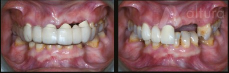 Before and After Dental