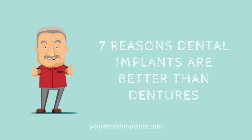 7 Reasons Dental Implants Are Better Than Dentures