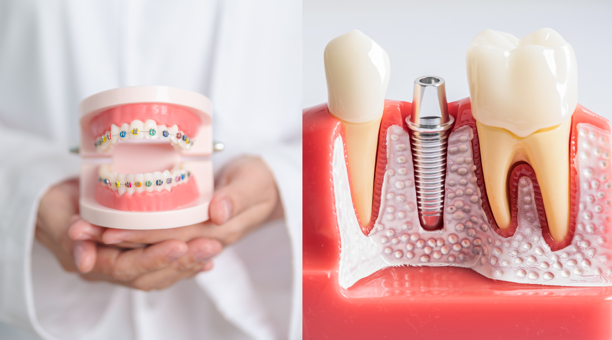 Can You Combine Orthodontics and Dental Implants? Here’s What to Know