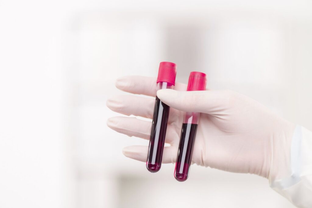 If you’ve been told you need implants and you’re on anticoagulants, here’s how to understand the process, reduce uncertainty, and ask the right questions.