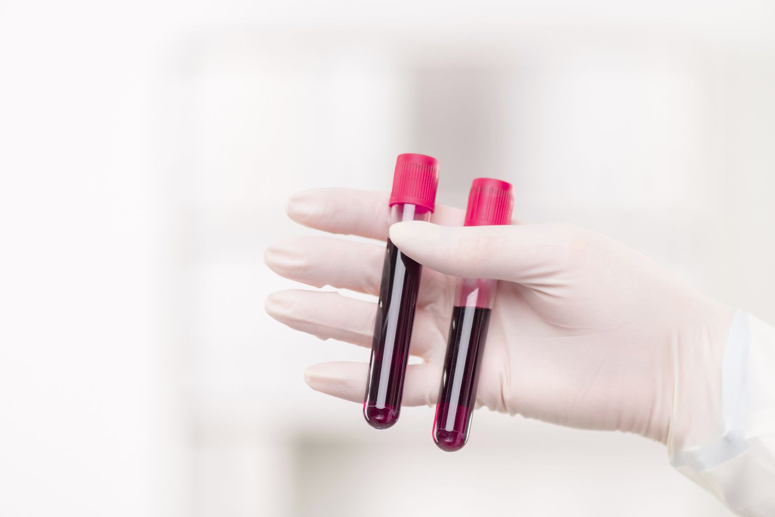 Dental Implants & Blood Thinners: What’s Safe and What to Ask