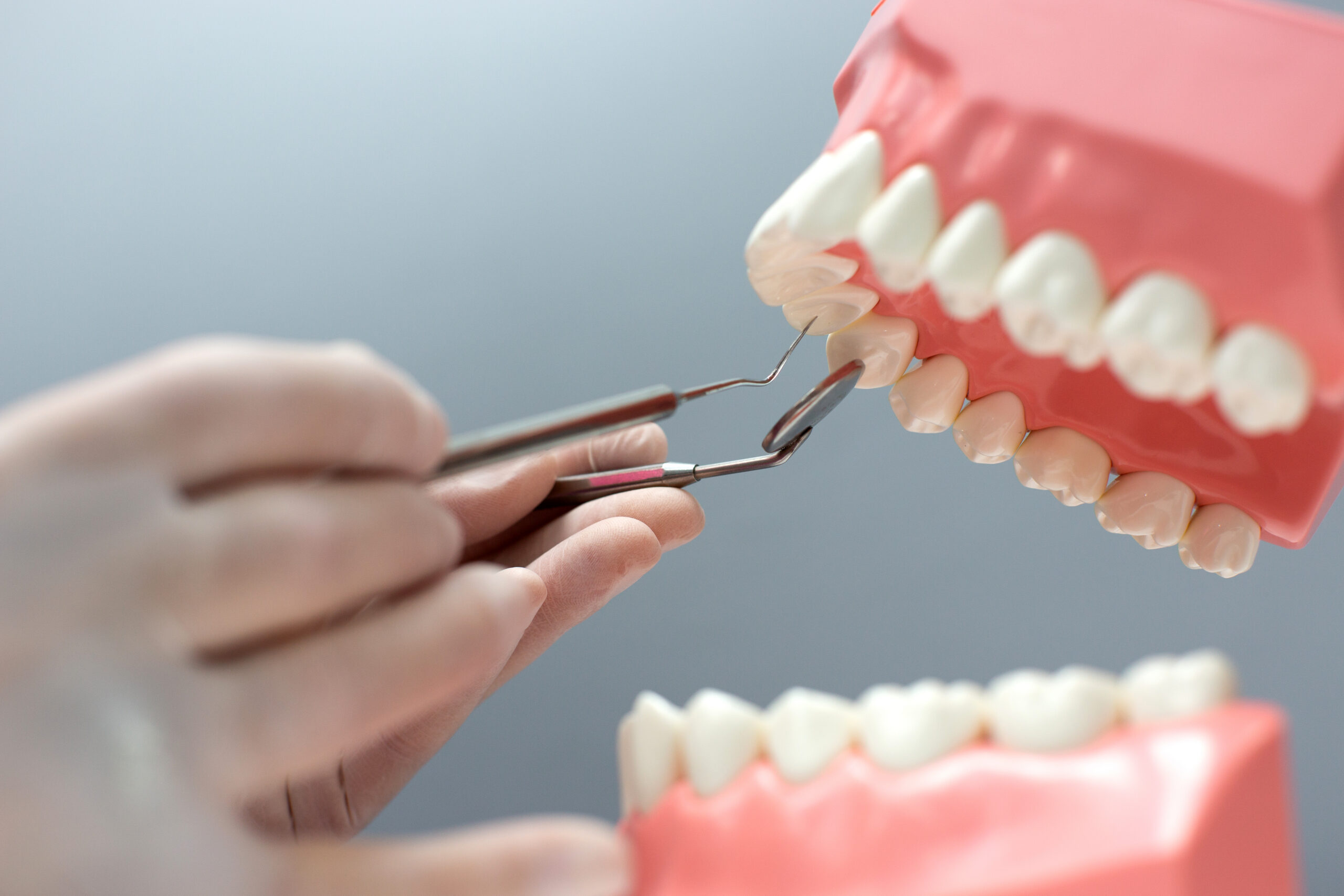 Peri-Implantitis: Signs, Causes, Treatment, and How to Protect Your Dental Implants